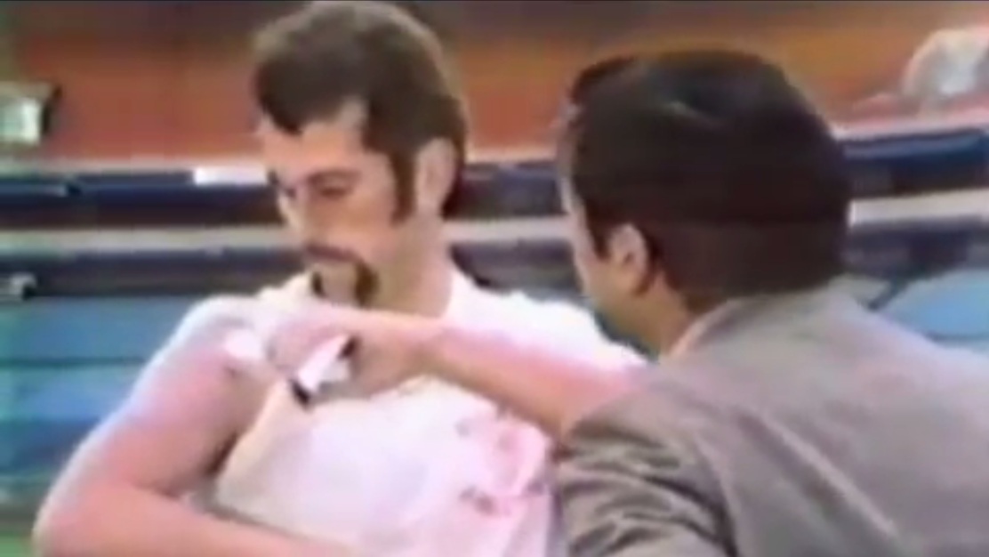 Patient in Georgia, a
                  football player treating himself with DMSO 01