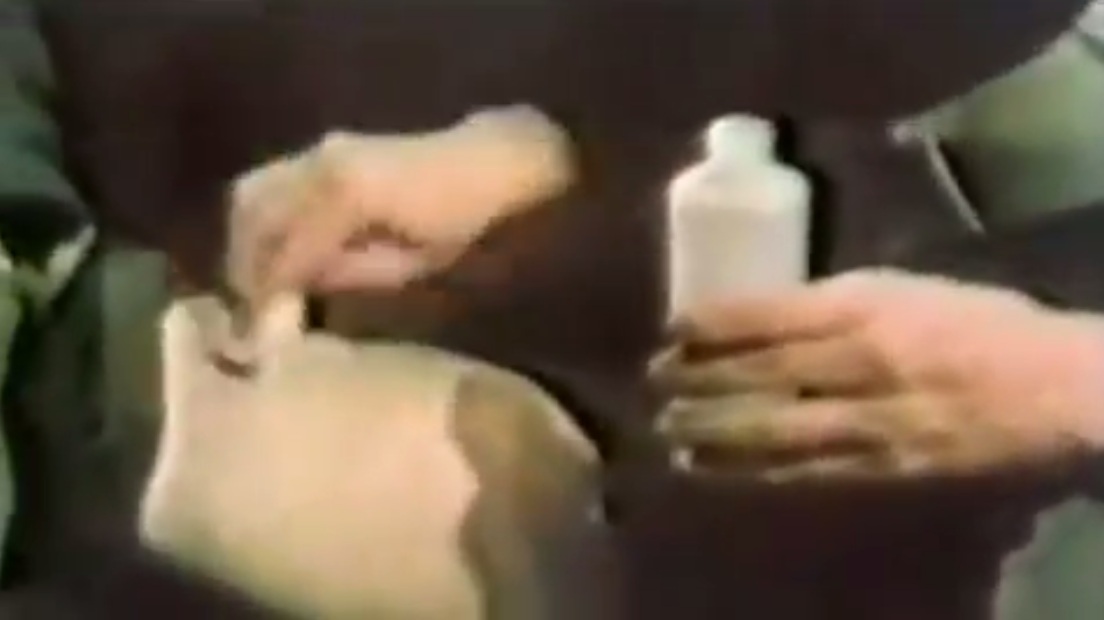 Dr. Jacob behandelt einen Patienten
                  mit DMSO am Oberschenkel