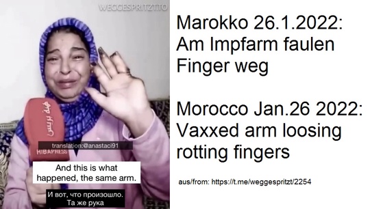 "Corona"
                        vaccine damage in Morocco: All fingers are
                        rotting off on the hand of the vaccination arm