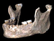 Amalgam-Quecksilber gelangt durch
                          den Zahn auch in den Kieferknochen. Das wissen
                          nur wenige Leute, weil sie meinen, Z�hne seien
                          undurchl�ssig...