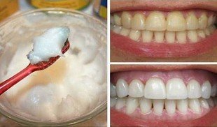 Kokos�l+Natron=Zahncreme