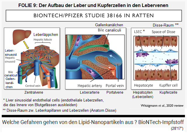 FOLIE 9: Der Aufbau der Leber -
                die Kupferzelle in den Lebervenen