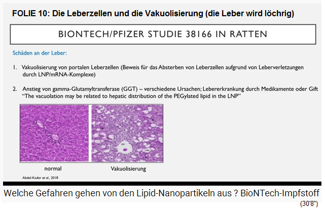 FOLIE 10: Die Leberzellen und
                  die Vakuolisierung (die Leber wird l�chrig wie ein
                  Emmentaler K�se)