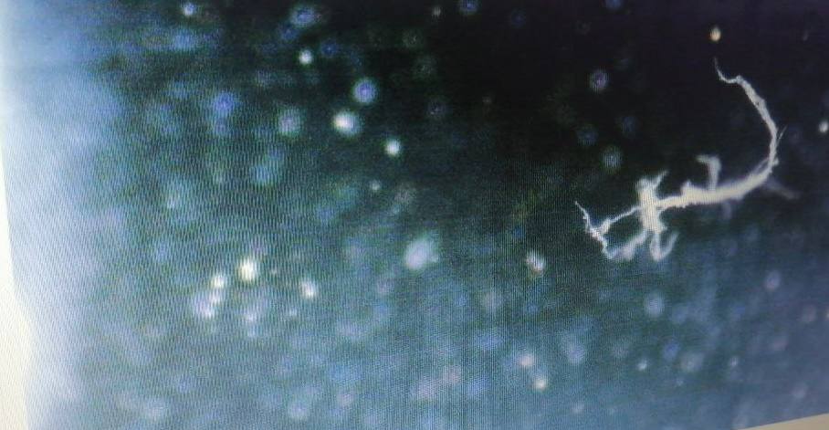 16-04-2022: Detalle de veneno de serpiente en la
                  vacuna de Pfizer - Dr. Ardis con microscopio