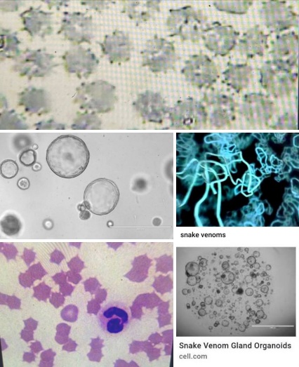 Ingredientes de
                  la vacunaci�n mortal de Pfizer 16-04-2022: Ya
                  encontraron veneno de serpiente otra vez - Dr. Ardis
                  con microscopio