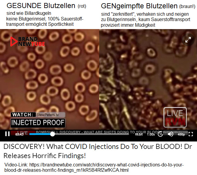 Vergleich von gesundem Blut mit
                  GENgeimpftem Blut mit zerknitterten Blutzellen, die zu
                  Thrombosen neigen