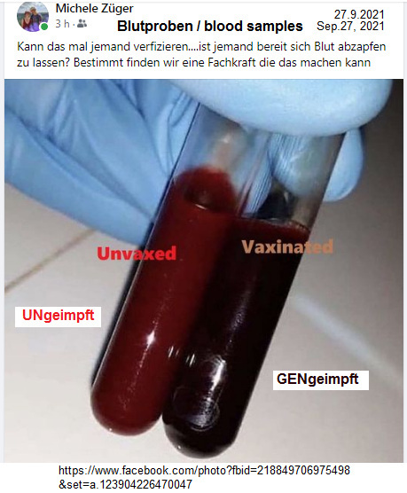 Vergleich von gesundem Blut (rot) und
                  GENgeimpftem Blut (dunkelbraun bis schwarz)