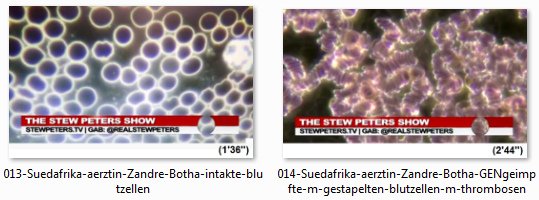 Vergleich intaktes und kaputtes Blut