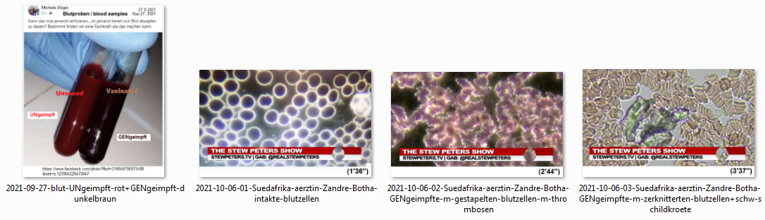 Vergleich intaktes und kaputtes Blut
                          02