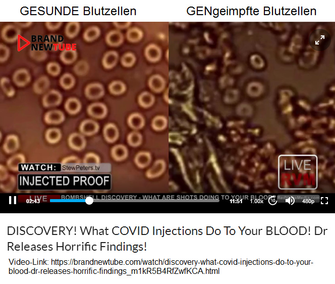 GESUNDE
                              Blutzellen - und GENgeimpfte Blutzellen:
                              Letztere sind verknittert und teilweise
                              schon verklumpt, Thrombosen k�ndigen sich
                              an