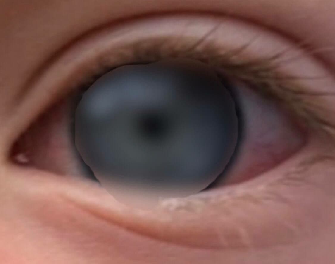 Shedding
                    rotes Auge 25.7.2021