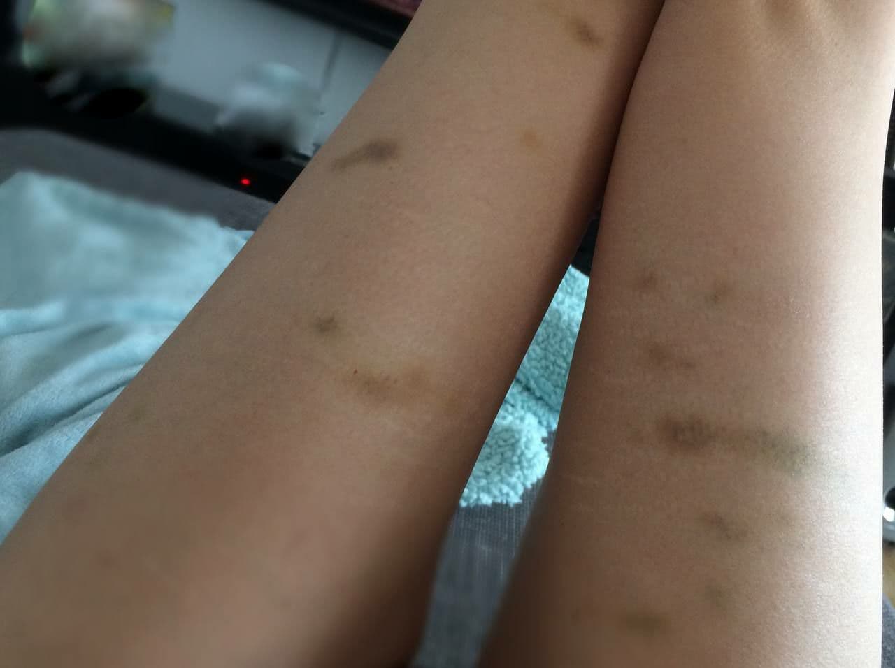 Shedding D-A-CH
                      30.7.2021: Baden im See provoziert Shedding