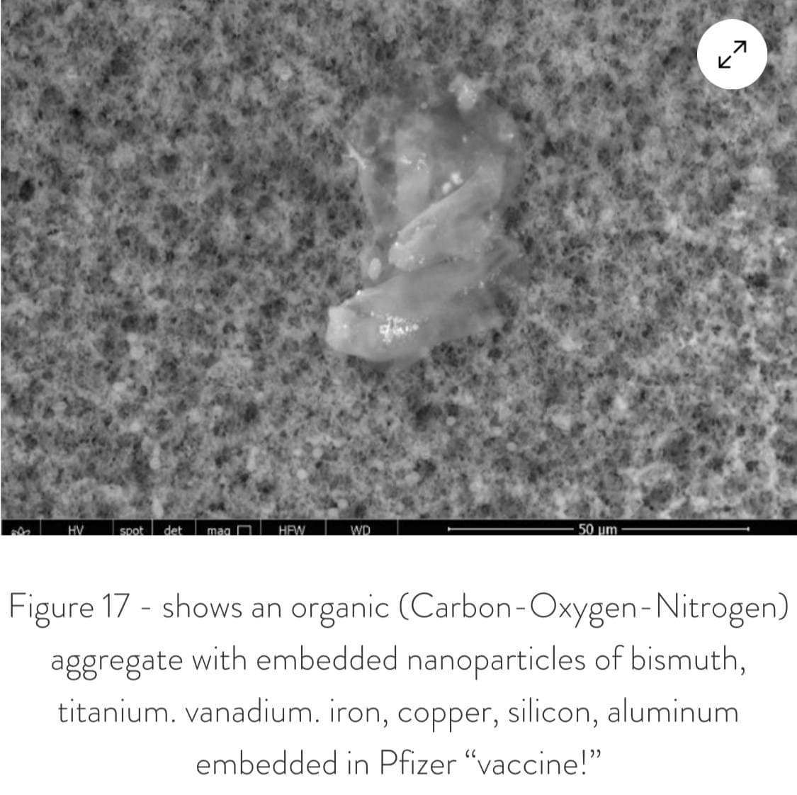 GENimpfwahn mit
                      Metallformation in der Pfizer-GENimpfung
                      30.8.2021