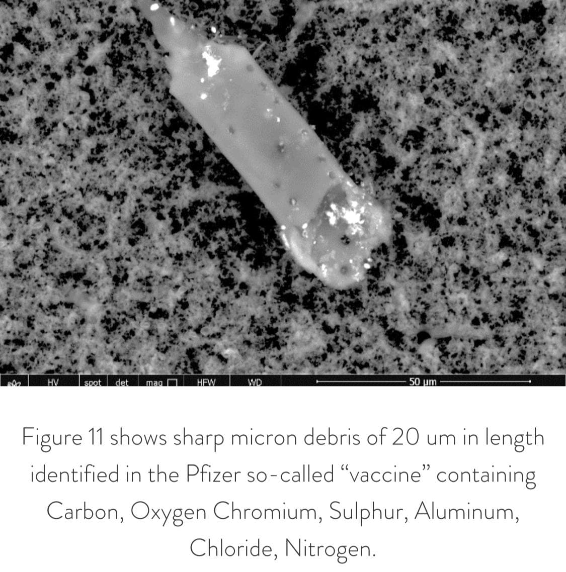 GENimpfwahn mit
                      Mikrobetallen in der Pfizer-GENimpfung 30.8.2021