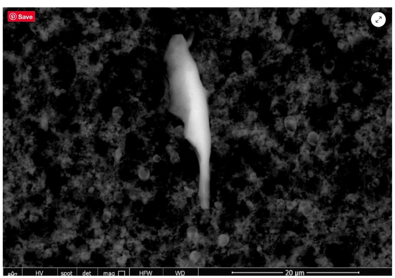 GENimpfwahn mit
                      verunreinigten GENimpfungen 30.8.2021: Parasit
                      Typsopanus in der Pfizer-Todesspritze