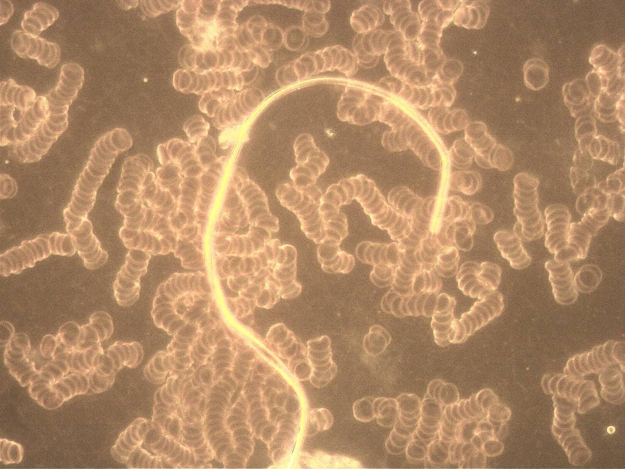 GENimpfschaden im Blutbild
                            15.9.2021: Foto 7