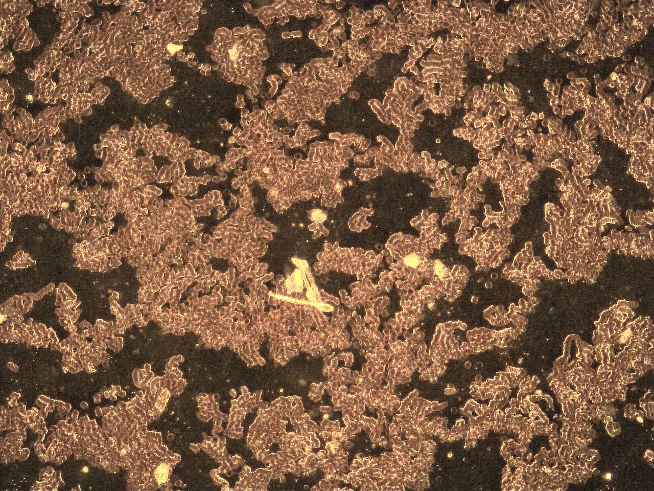 GENimpfschaden im Blutbild
                            15.9.2021: Foto 3