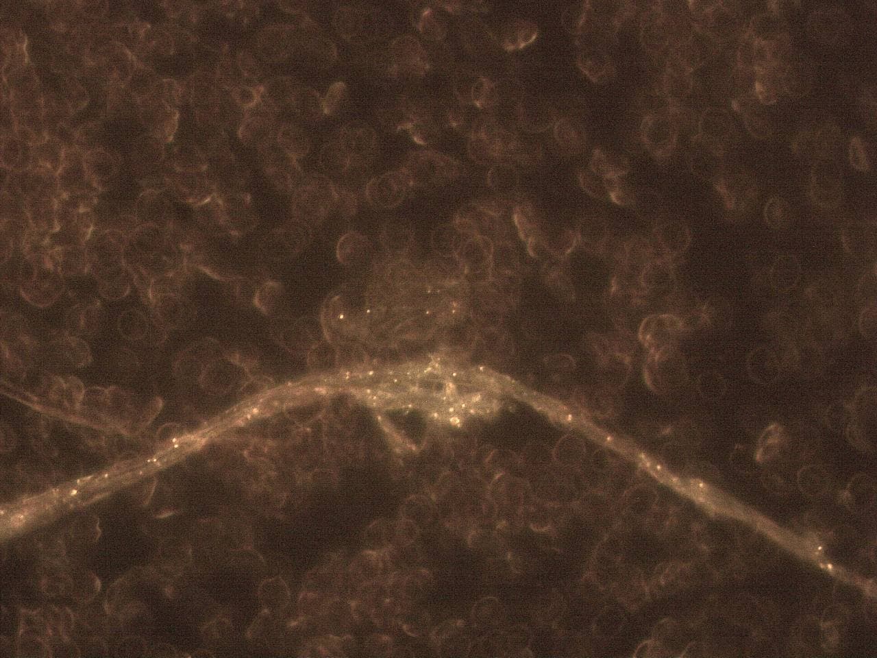 GENimpfschaden im Blutbild
                            15.9.2021: Foto 6