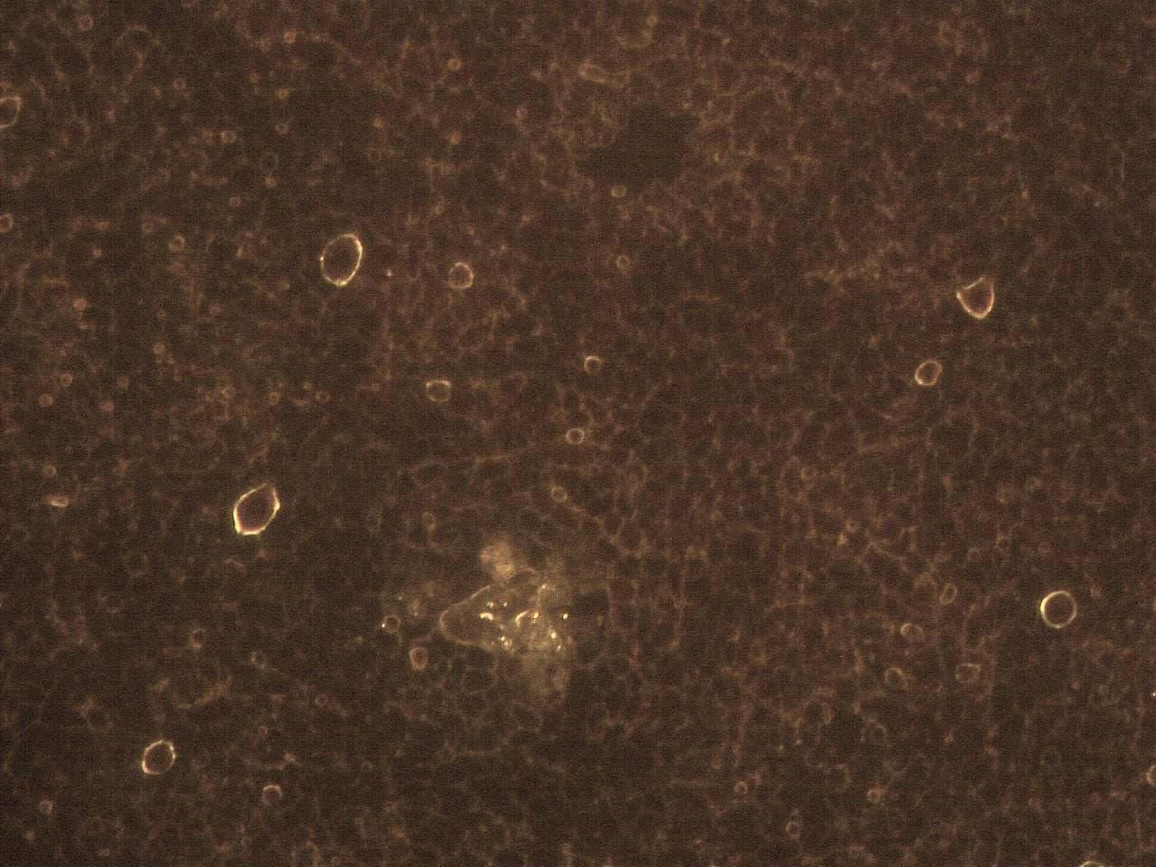 GENimpfschaden im Blutbild
                            15.9.2021: Foto 4