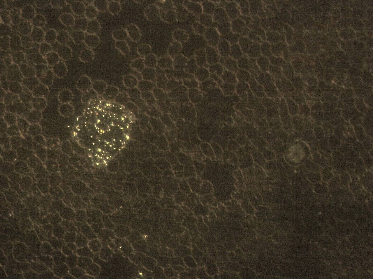 GENimpfschaden im Blutbild
                            15.9.2021: Foto 2