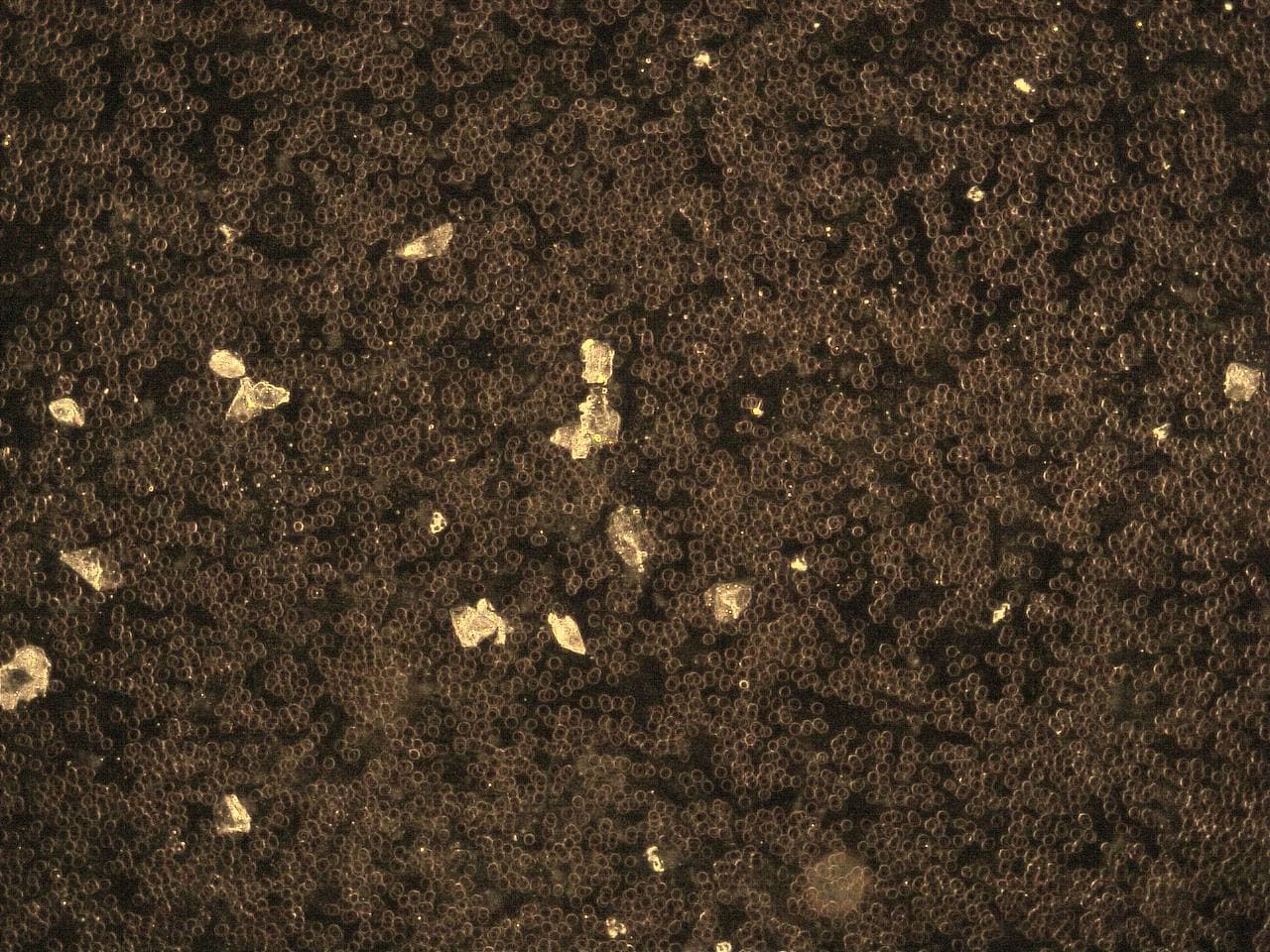 GENimpfschaden im Blutbild
                            15.9.2021: Foto 9