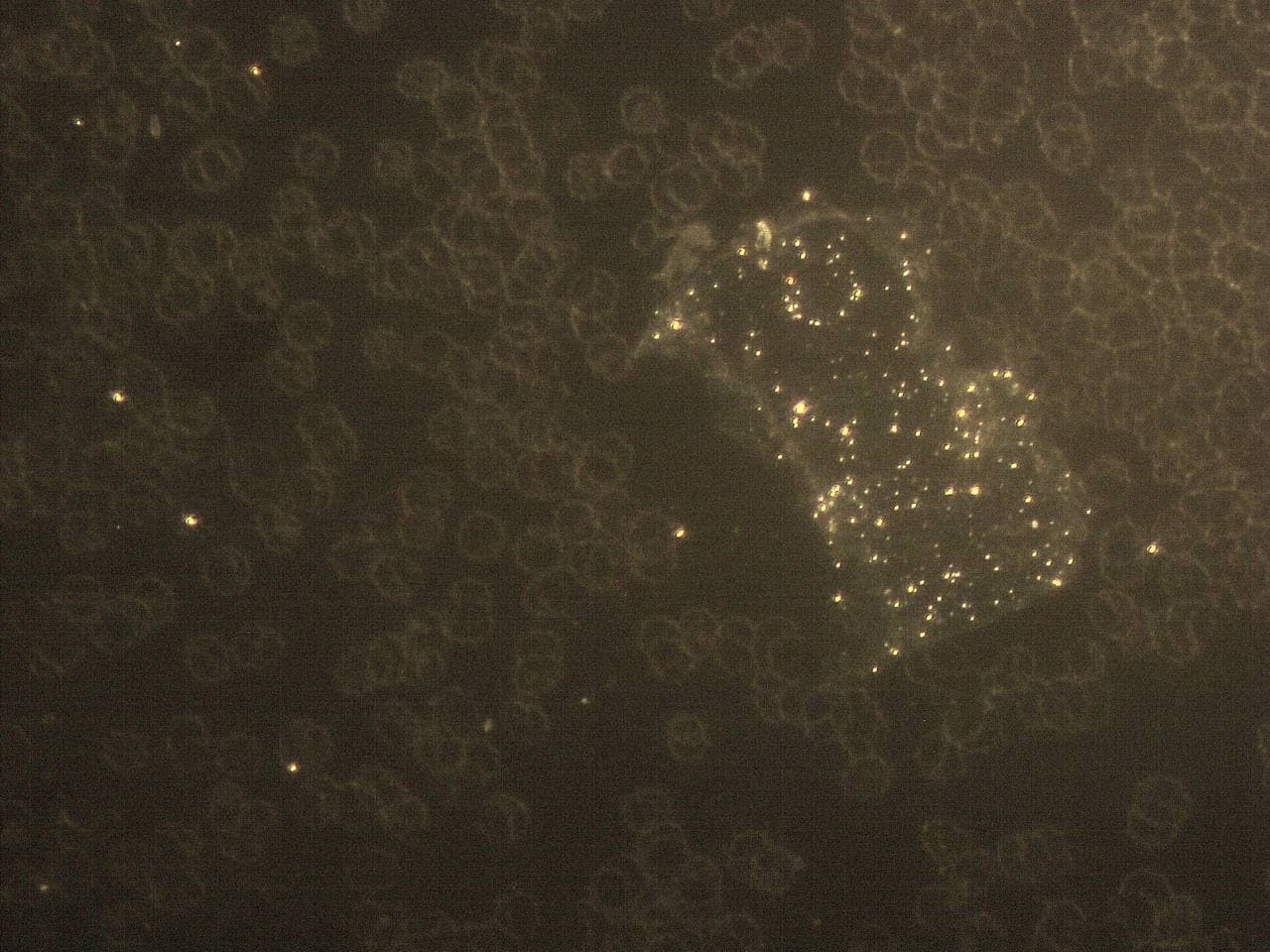 GENimpfschadne im Blutbild
                            15.9.2021: Foto 1