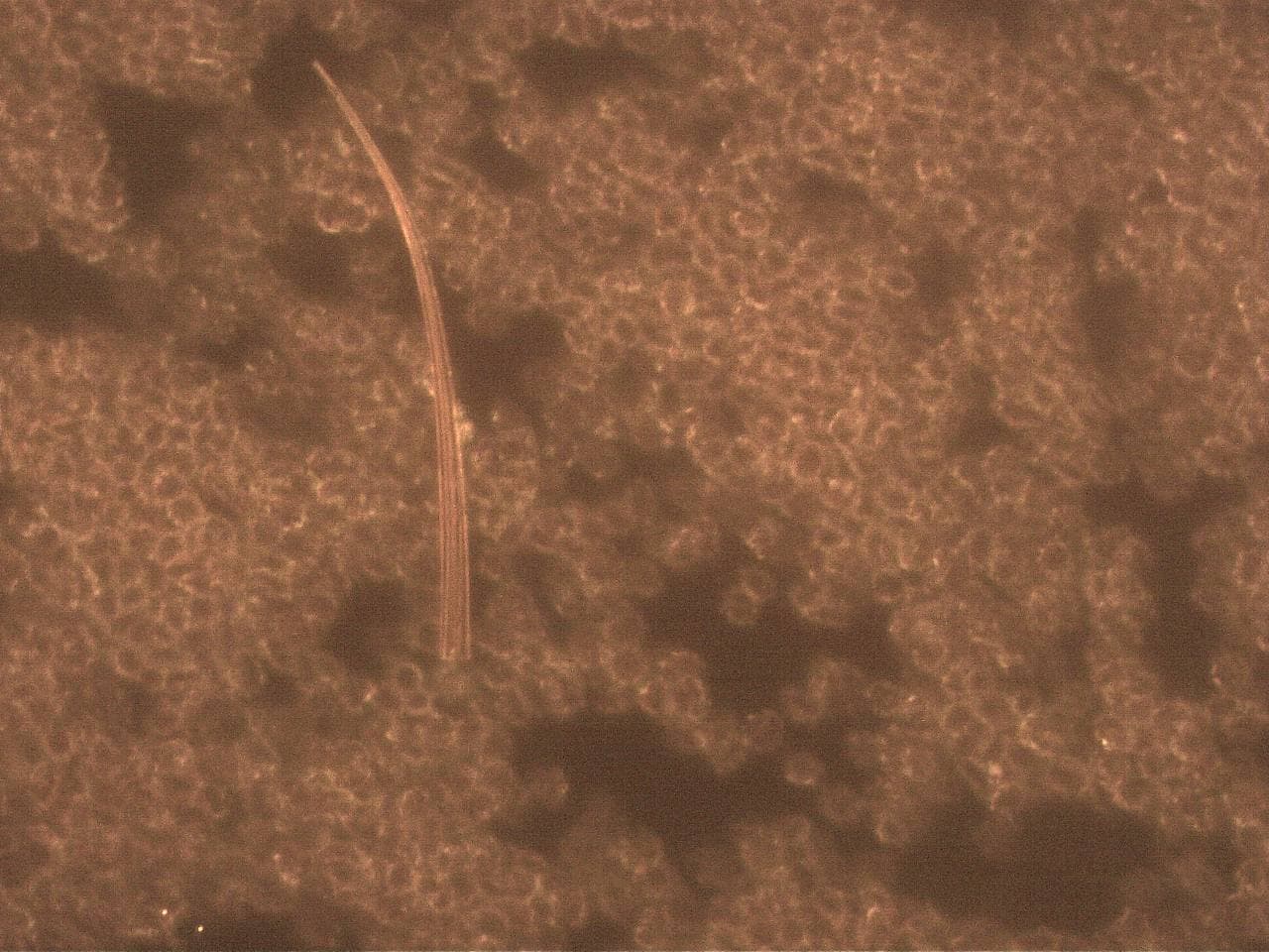 GENimpfschaden im Blutbild
                            15.9.2021: Foto 8