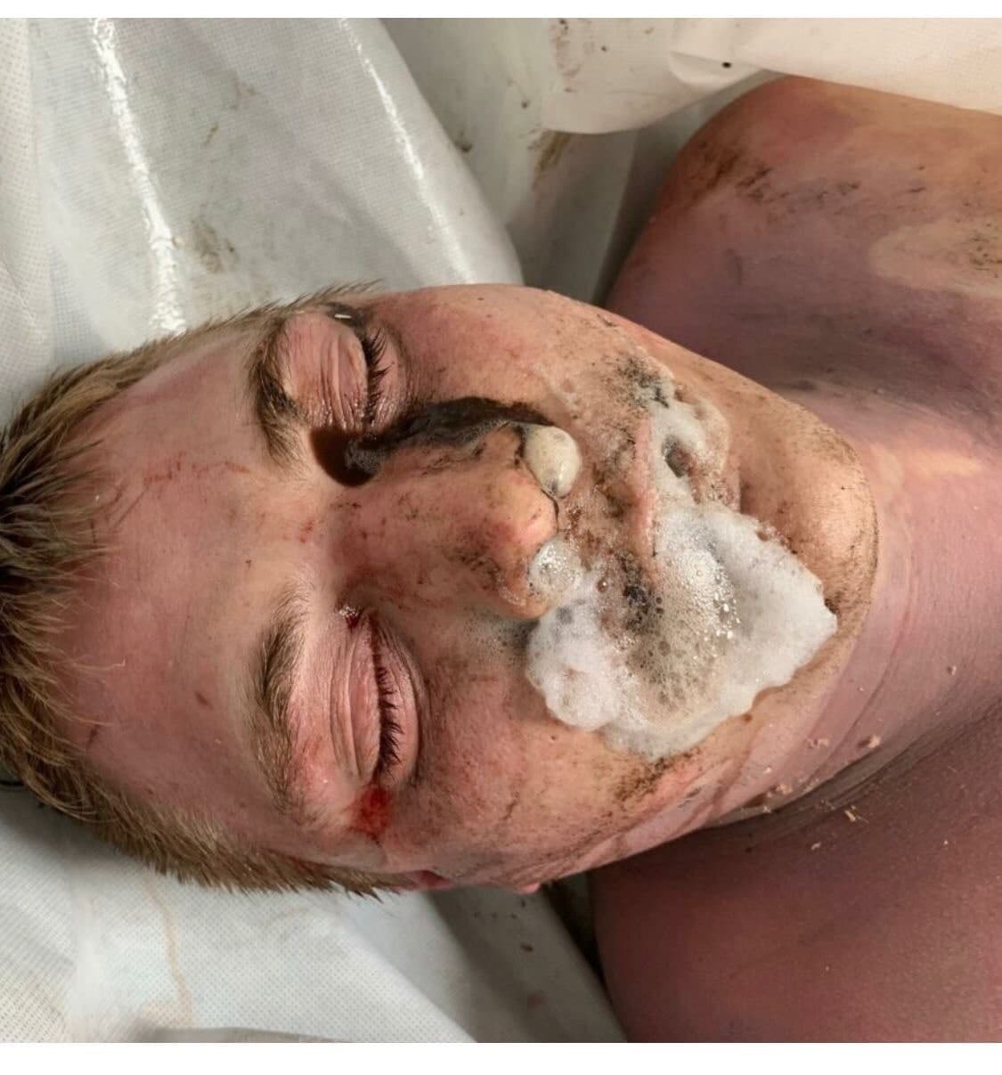 GENimpfmord 21.9.2021: Mann (30) tot nach
                        GENimpfung mit Schaum vor dem Mund