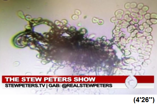 Südafrika: Ärztin Zandre Botha: Schwarzes
Objekt wie ein schwarzes Wildschwein im Blut Südafrika: Ärztin Zandre Botha: Schwarzes Objekt
wie ein schwarzes Wildschwein im Blut