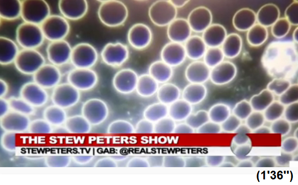 S�dafrika:
                  �rztin Zandre Botha: Hier sind intakte Blutzellen wie
                  Billardkugeln