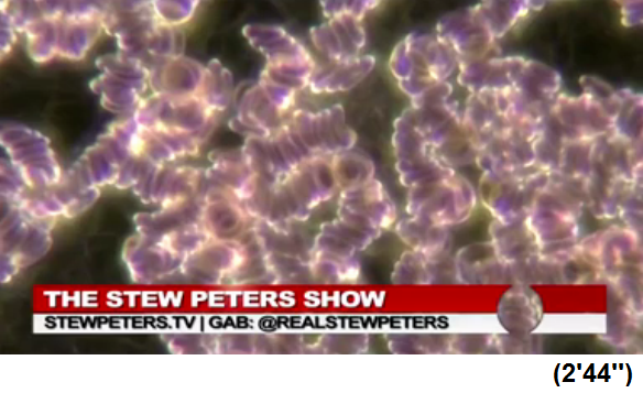 Südafrika: Ärztin Zandre Botha: Blutzellen sind
gestapelt und bilden Thrombosen Südafrika:
Ärztin Zandre Botha: Blutzellen sind gestapelt und
bilden Thrombosen