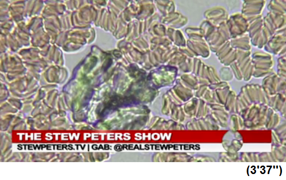 Südafrika: Ärztin Zandre Botha: Schwarzes
Objekt wie eine Schildkröte im Blut Südafrika:
Ärztin Zandre Botha: Schwarzes Objekt wie eine
Schildkröte im Blut