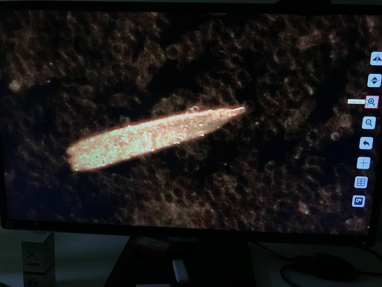 Blutbild nach
                  GENimpfung: Verklebte Blutk�rperchen+Fremdk�rper 6