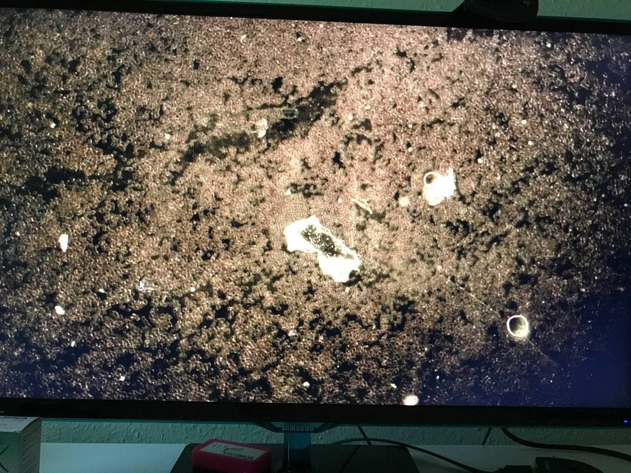 Blutbild nach
                  GENimpfung: Verklebte Blutk�rperchen+Fremdk�rper 01