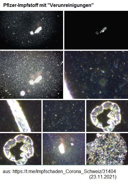 Todesspritze von Pfizer 23.11.2021:
                          Pfizer-Impfstoff mit
                          "Verunreinigungen" - Fotosammlung 1