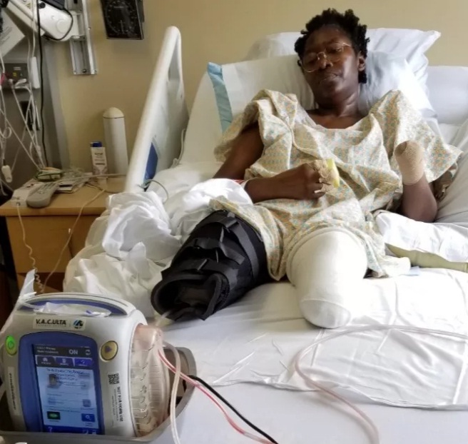 Jummai Nache
                    [Minneapolis] : 47-j�hriger Arzthelferin wurden kurz
                    nach Erhalt des zweiten Pfizer-Impfstoffs die linke
                    Hand, die rechten Finger und beide Beine amputiert