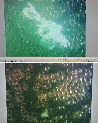 GENimpfschaden Schweiz 24.11.2021: Sehst�rungen,
                �elkeit, blutiger Stuhlgang, Schwindel, Hirnschaden mit
                Ged�chtnisst�rung, L�hmungen, Milz gr�sser