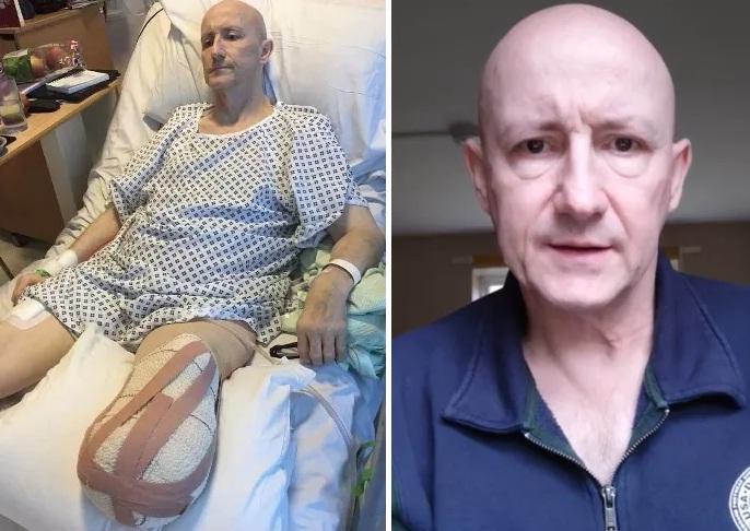 Dave Mears: Nach GENimpfung
                      von AstraZeneca Bein amputiert