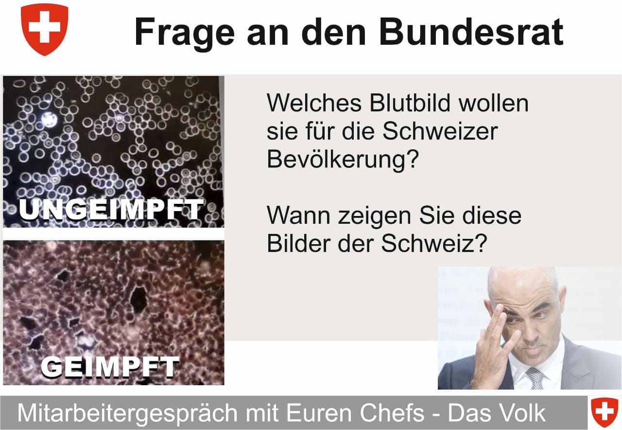 GENimpfschaden Blutbild 3.12.2021: Gesundes
Blut verglichen mit zerstörtem, GENgeimpftem Blut: Der
Lügen-Bundesrat Berset will das dem Volk
verheimlichen! GENimpfschaden Blutbild
3.12.2021: Gesundes Blut verglichen mit zerstörtem,
GENgeimpftem Blut: Der Lügen-Bundesrat Berset will das
dem Volk verheimlichen!