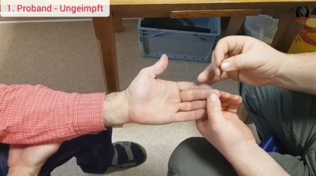 Ein Tropfen Blut des ersten Ungeimpften
wird abgenommen Screenshot, Bildzitat Ein
Tropfen Blut des ersten Ungeimpften wird
abgenommen Screenshot, Bildzitat