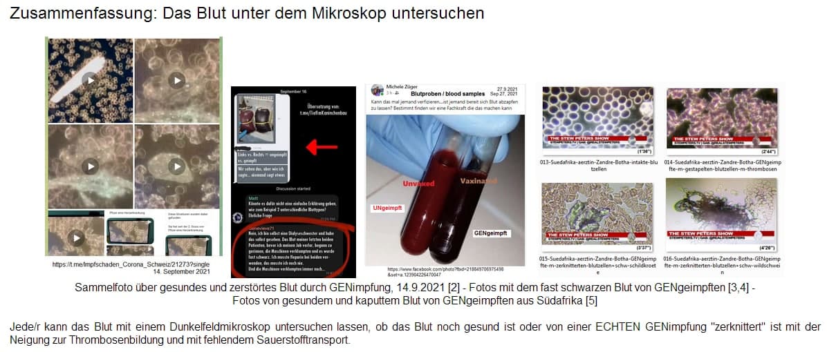 Blutuntersuchung mit Dunkelfeldmikroskop
                    17.12.2021: Webseite mit Naturheilpraktikern, wo man
                    sich in der Schweiz testen lassen kann