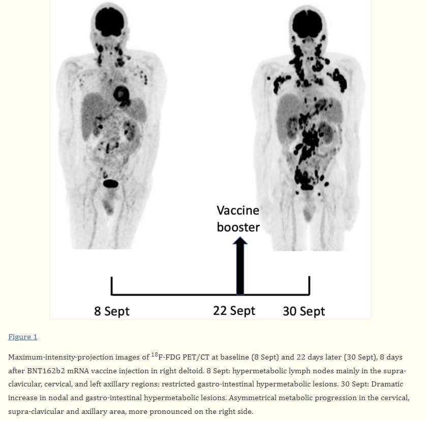 3. GENimpfung f�rdert
                  Krebs weltseit 27.12.2021: Fotobeispiel