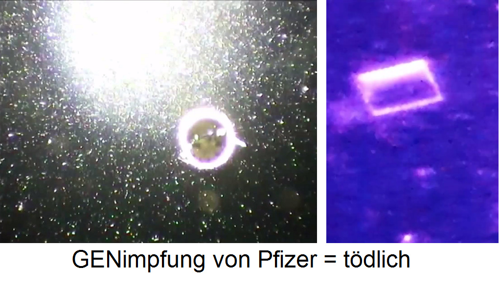 Pfizer-GENimpfstoff
                                unter dem Dunkelfeldmikroskop mit
                                Blasen, Schl�uchen und rechteckigen
                                Nanoteilchen