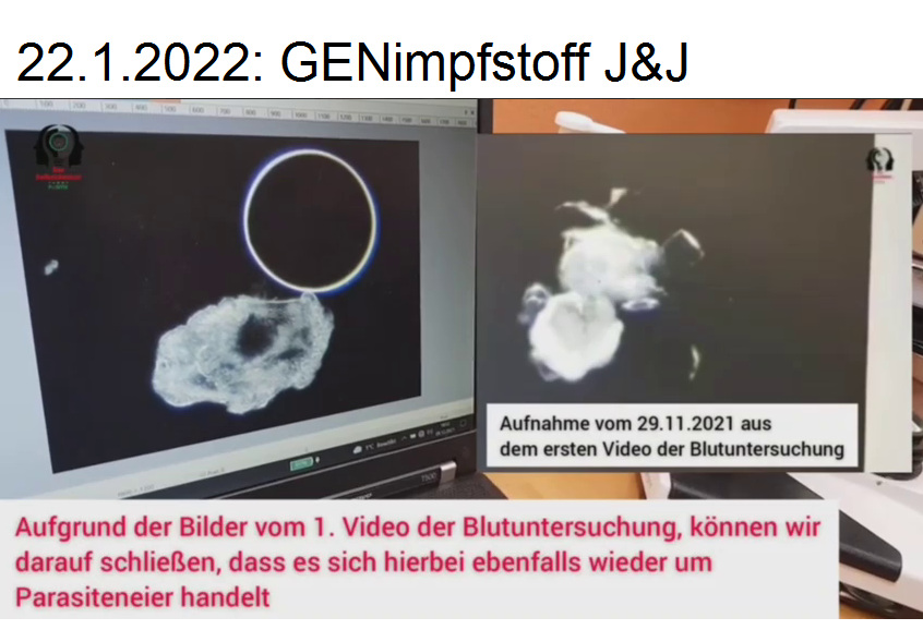 Inhaltsstoffe von J&J
                      22.1.2022: Parasiteneier