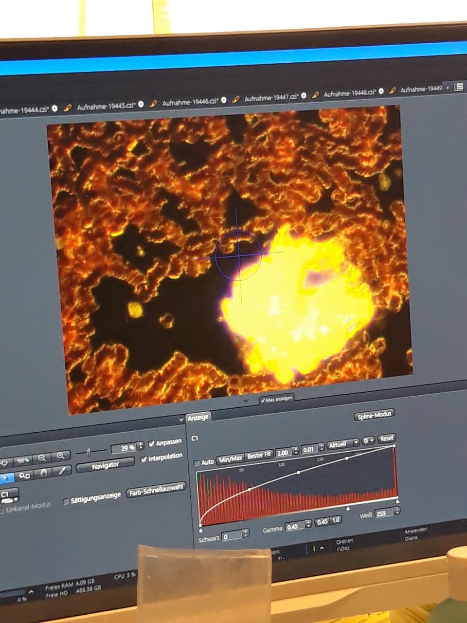 Shedding am
                  17.2.2022: Shedding tagelang im Klassenzimmer macht
                  das Blut kaputt