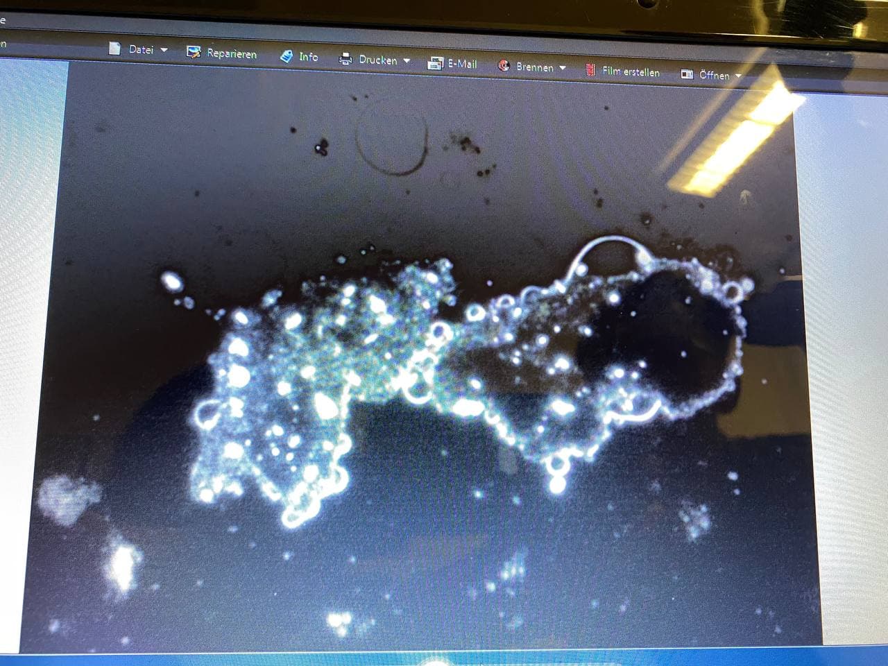 GENimpfschaden Schweiz 28.2.2022: Blutschaden
bei 3x GENimpfung: Blutkörperchen bilden Klumpen GENimpfschaden Schweiz 28.2.2022: Blutschaden
bei 3x GENimpfung: Blutkörperchen bilden Klumpen