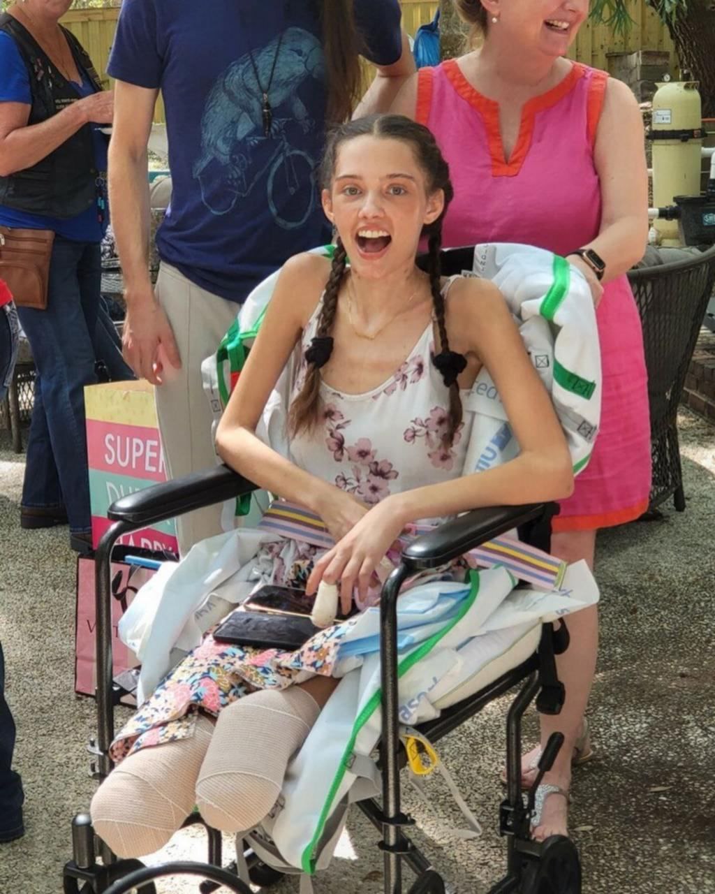 Florida
                  28.3.2022: Model Claire Bridges verliert beide
                  Unterschenkel und F�sse durch Amputation nach 2facher
                  GENimpfung 2