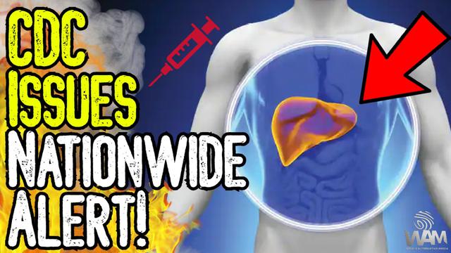 T�ter CDC 23.4.2022: warnt
                    nun vor Lebersch�den bei Kindern nach der t�dlichen
                    GENimpfung: (NEW video up! Children are suddenly
                    having liver failure! The CDC has put out a
                    nationwide alert)