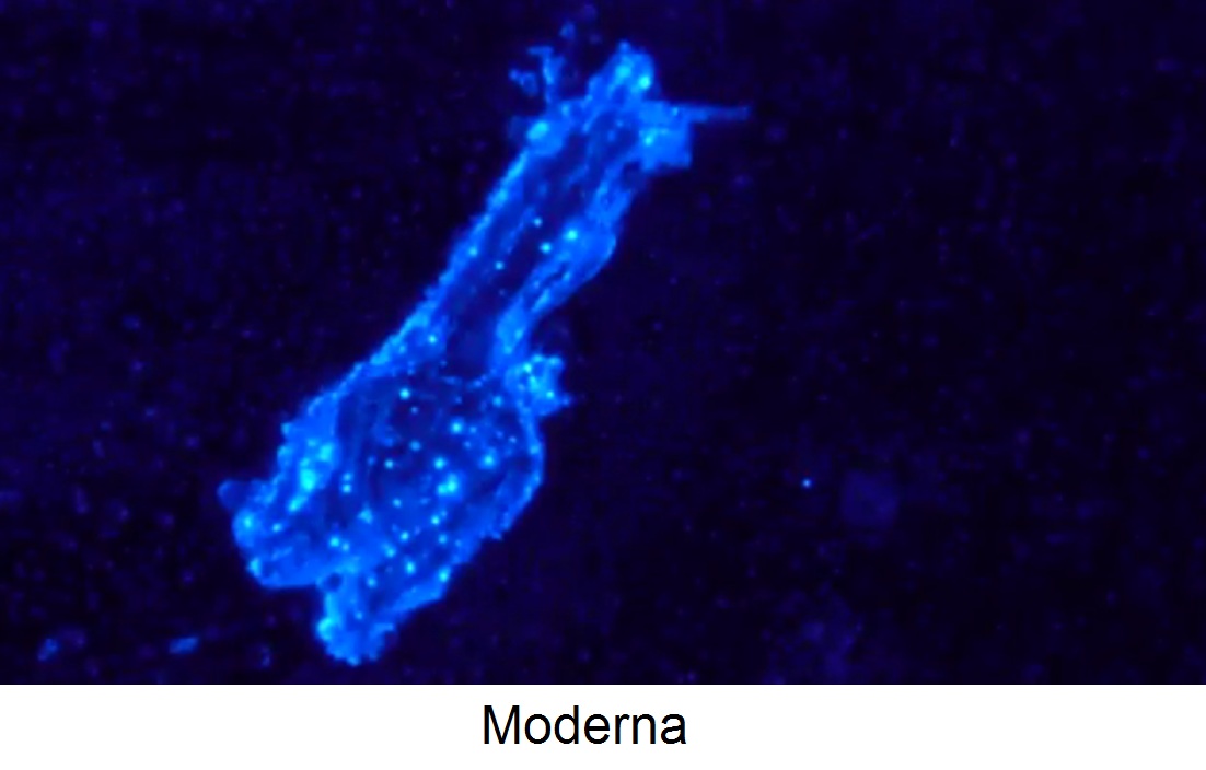 Video: Schweiz
                      4.5.2022: Moderna-Impfung mit Flugzeugen drin
                      (9'39'') (Suisse/Switzerland 4-5-2022 Moderna
                      vaccine with airplanes - vaccin de Moderna avec
                      des avions)