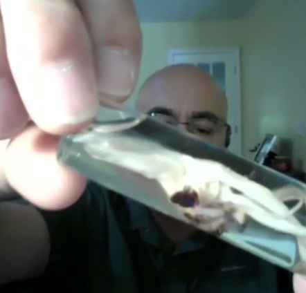 Einbalsamierer Hirschmann zeigt weisses
Faserblutgerinnsel 01 in einem Glas konserviert
(16'18'') Einbalsamierer Hirschmann zeigt
weisses Faserblutgerinnsel 01 in einem Glas
konserviert (16'18'')